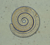 Trichinella_larva1.JPG